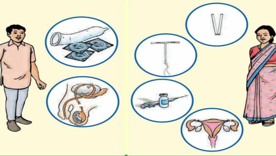 सुदूरपश्चिममा ६ महिनादेखि परिवार नियोजनका अस्थायी साधनको अभाव