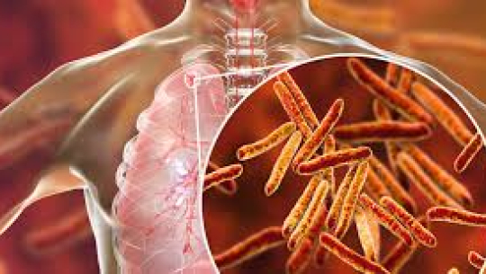 बैतडीका दुई पालिकामा क्षयरोगमुक्त नेपाल अभियान सुरु