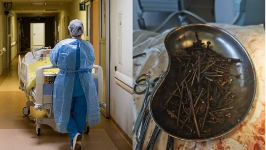 रक्सी छोडेका युवकले खाए एक किलो फलामको काँटी