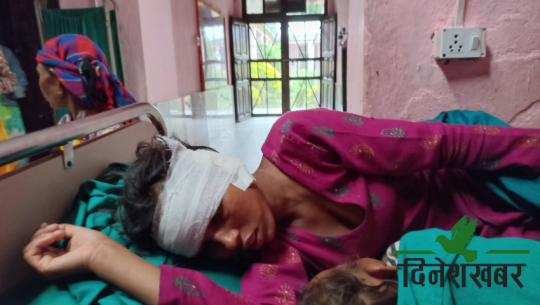 Husband tears wife’s ear for laughing in front of his relatives