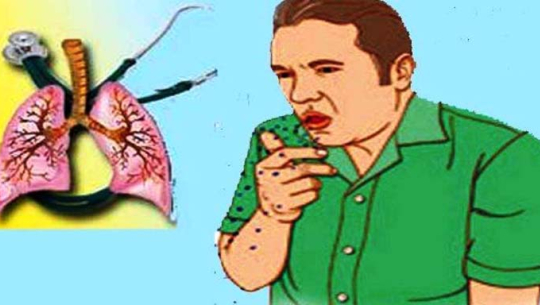 अछाममा चालु आर्थिक वर्षको फागुनसम्ममा ८१ जना क्षयरोगका बिरामी