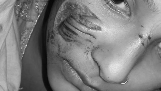 Problem of mad dogs curbed by the authority