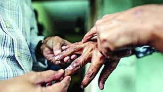 नवलपुरमा भेटिए १४ कुष्ठरोगी