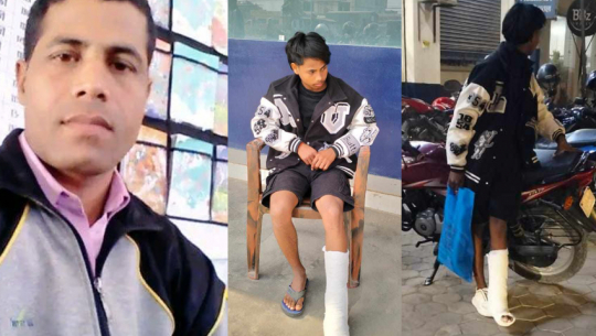 Student Hospitalized After Being Assaulted by Teacher's Brother in Dhangadhi