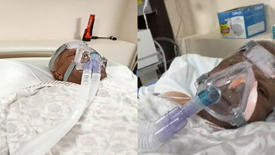 पूर्वमुख्यमन्त्री लालुको घरमा लडेर काँध भाँचिएपछि...