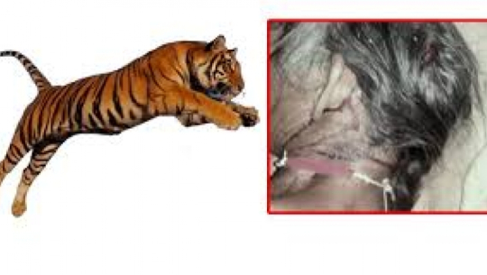 Leopard attack injures one in Baitadi