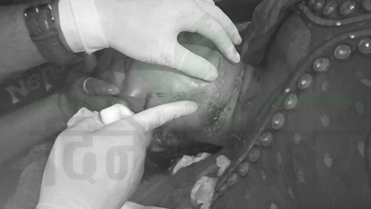 बझाङमा महिलाको गहना लुटपाट गरी हत्या गर्ने प्रयास