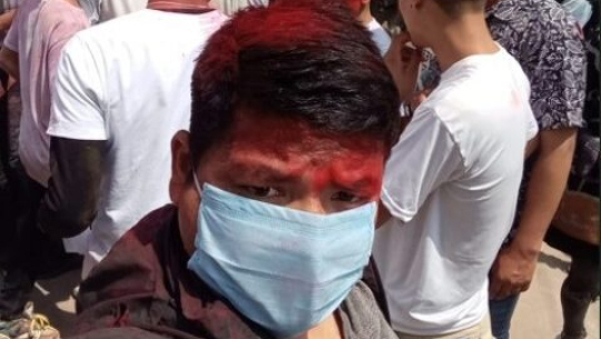कैलालीमा पालिका अध्यक्षलाई कालोमोसो लगाउने पक्राउ