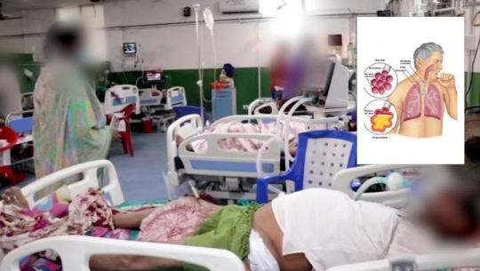 पोष्ट कोभिडका बिरामी बढ्दै