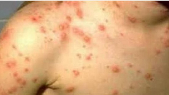 फाइल फोटो 