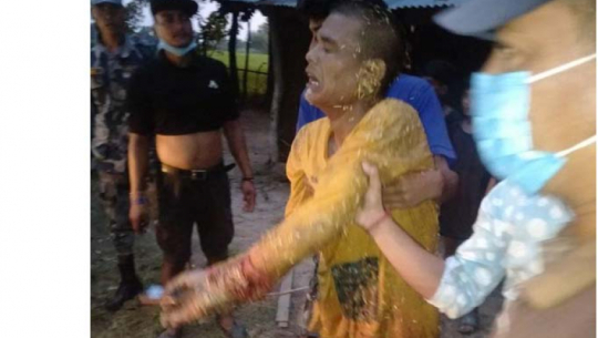 Three severely injured in a clash in Tikapur