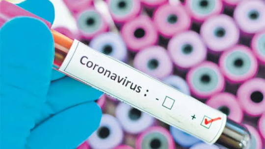 नेपालमा थप १ सय ४५ जनामा कोरोना सङ्क्रमण पुष्टि