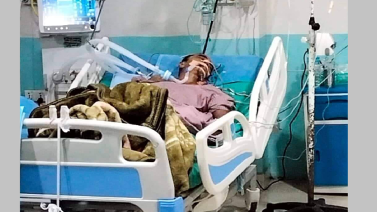 कञ्चनपुरमा करेन्ट लागेर गम्भीर घाइते भएका चन्दको उपचारका लागि आर्थिक अभाव 